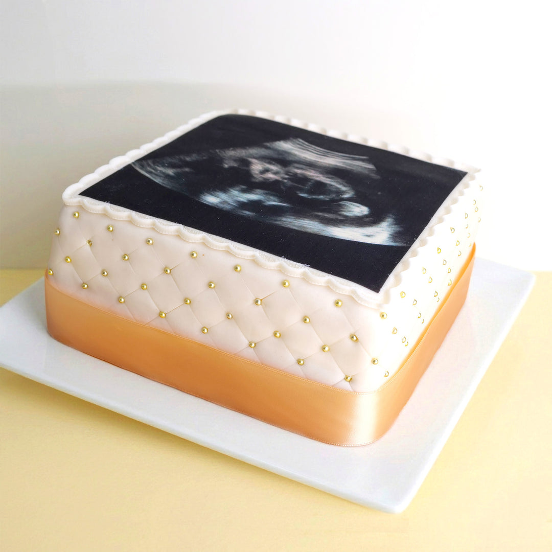 Square Ultrasound Cake Deluxe – Double Height