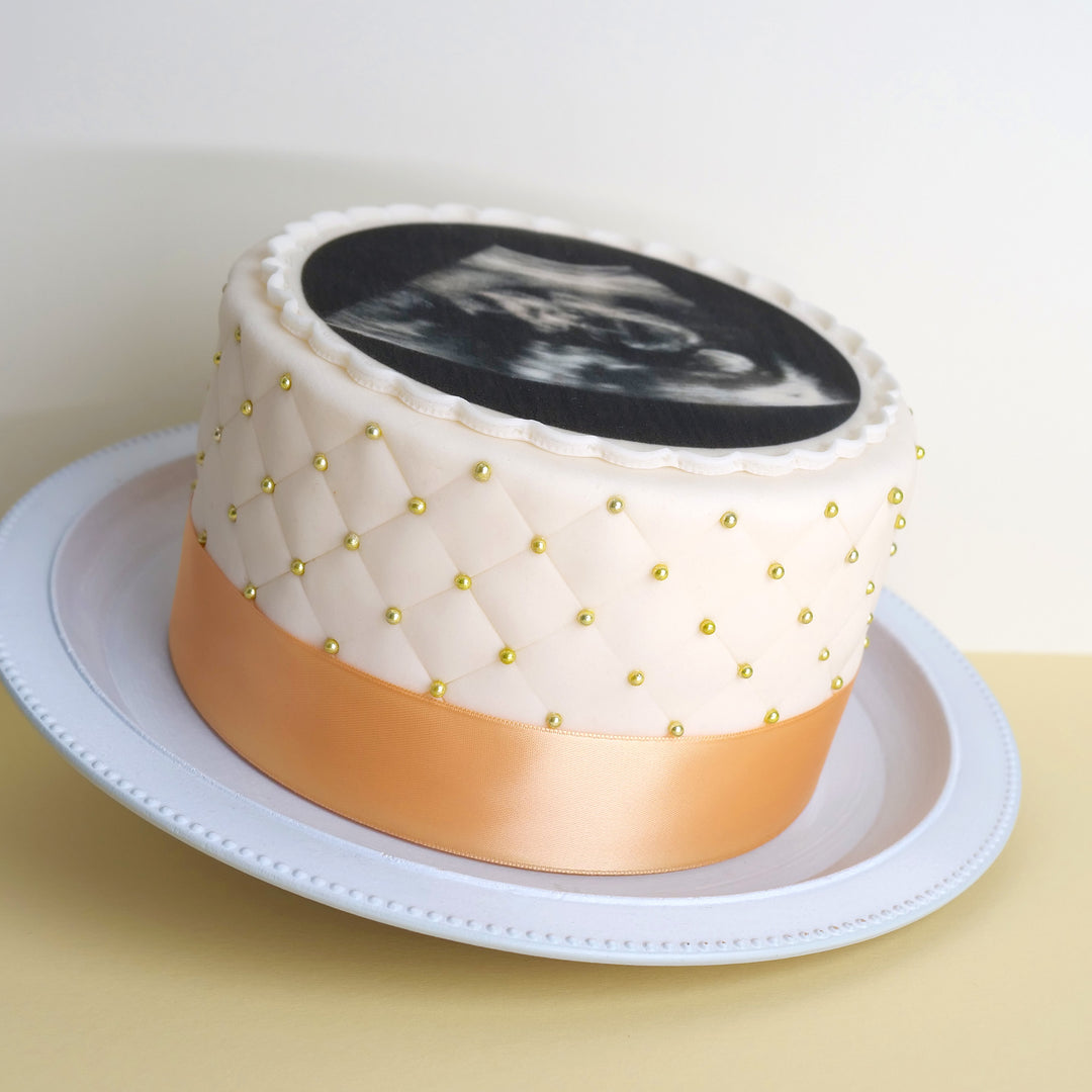 Deluxe round ultrasound cake with your own photo – double height